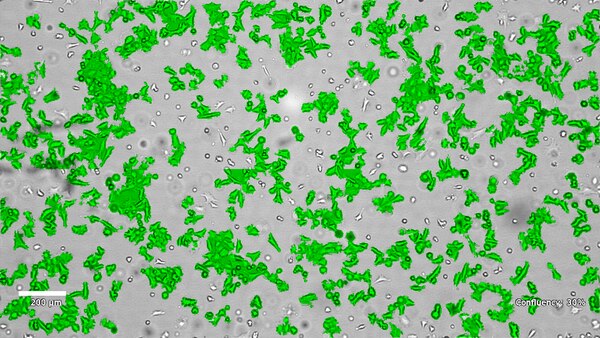 SCp2 Mouse Mammary Epithelial Cell Line | SCC458